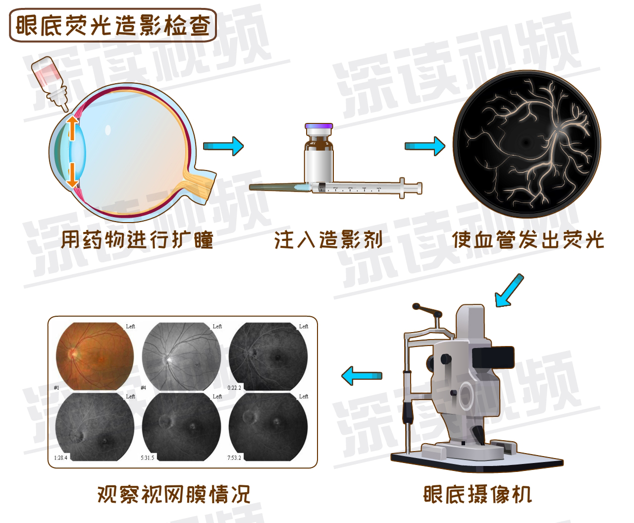 激光烫眼?手术切割玻璃体?谁才能安全有效治糖网?