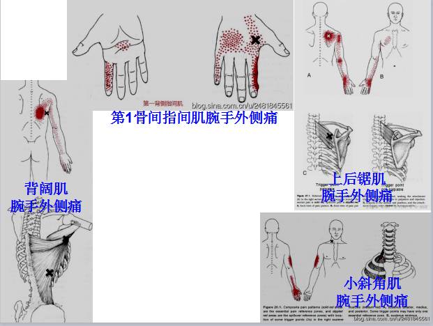 ni)肱肌(brachialis)岡下肌(infraspinatus)橈側腕長伸肌(extensor