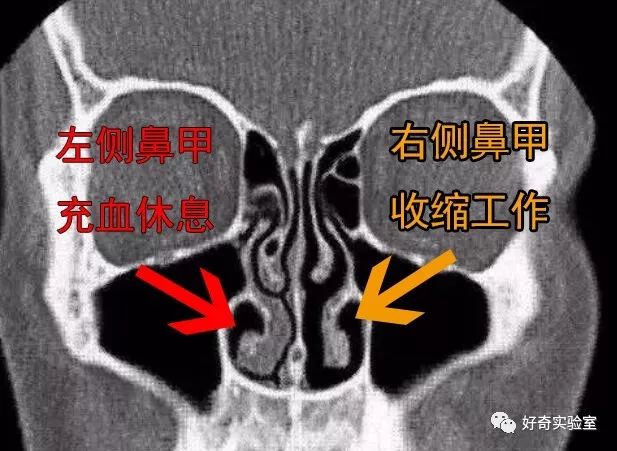 另一个鼻孔"休息"的状态形成一个鼻孔"工作"导致鼻甲大小和阻力不同