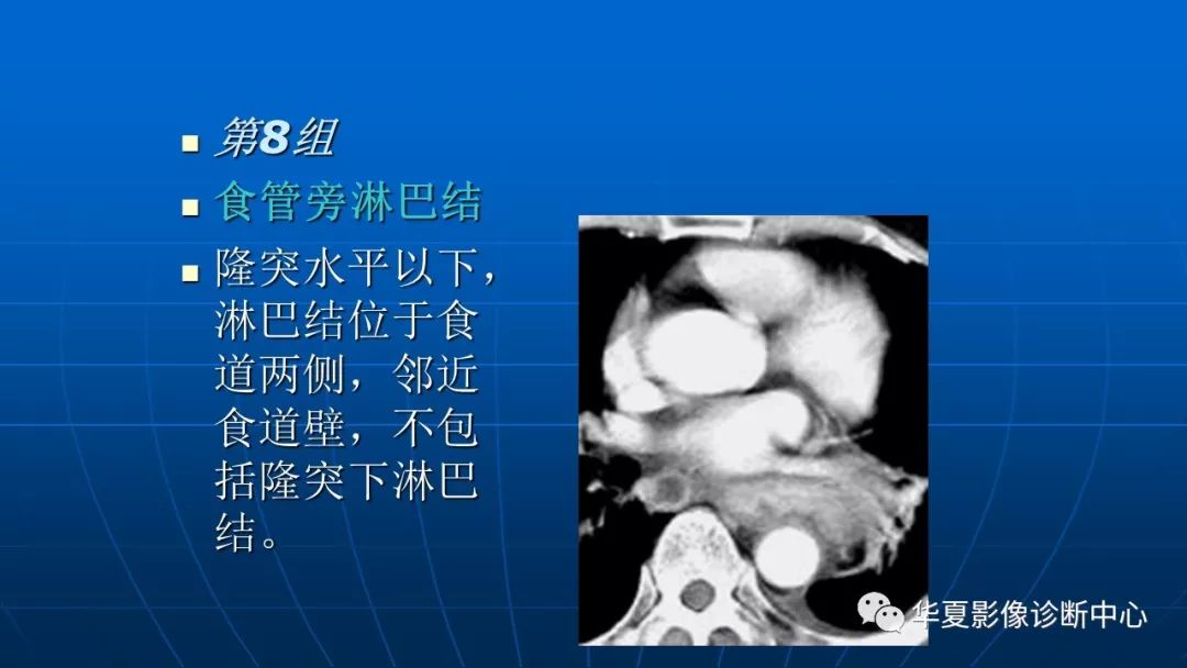 肺癌分期纵隔淋巴转移ct展示