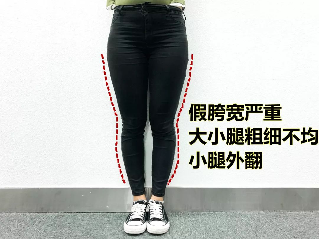 真"时尚风向标"戚薇,周冬雨,用ta轻轻松松凹出大长腿