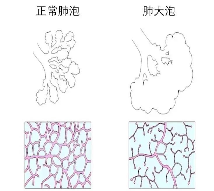 买买买之后电子烟就不要再买了