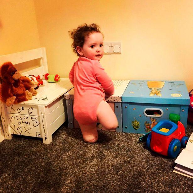 300万分之1英国女婴天生没胫骨双腿截肢后2岁竟能迅速行走