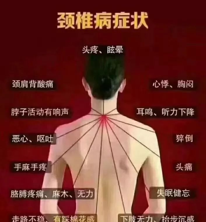 颈椎病疼的位置图片图片