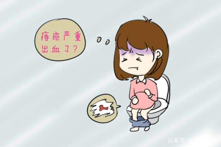 孕妇痔疮犯了怎么办(孕妇痔疮犯了怎么办?特别疼)-第1张图片-鲸幼网