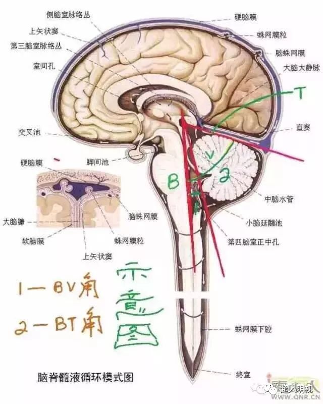 小脑脚解剖图片