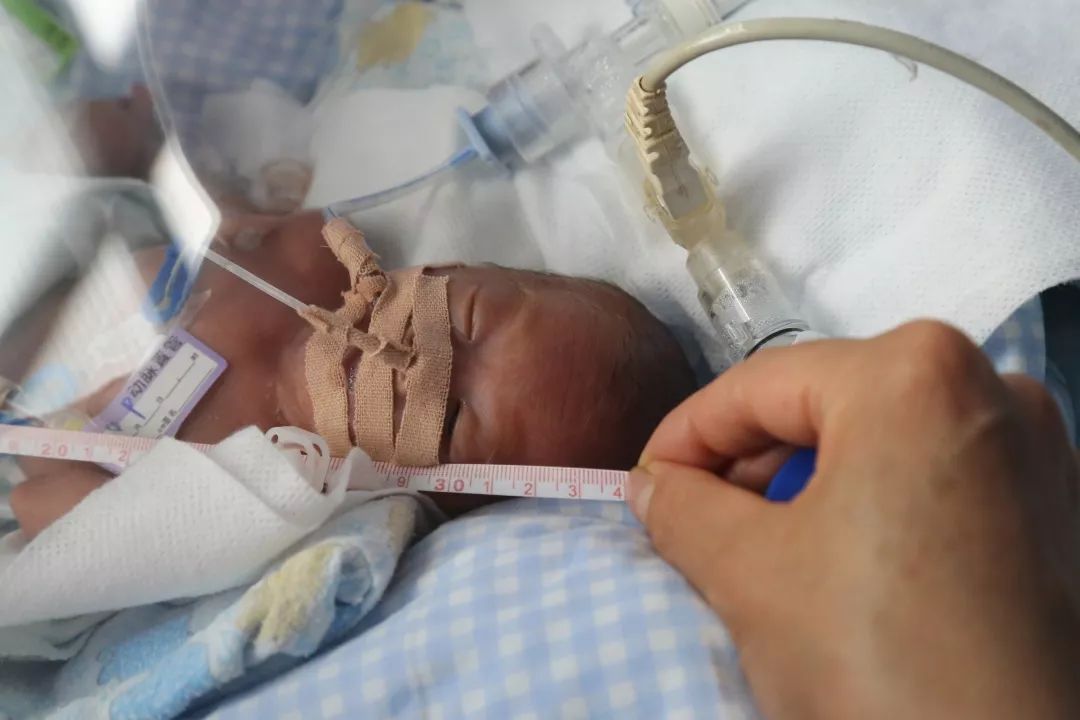 出生700克 徐州市妇幼保健院超小宝宝的成长日志_新生儿科