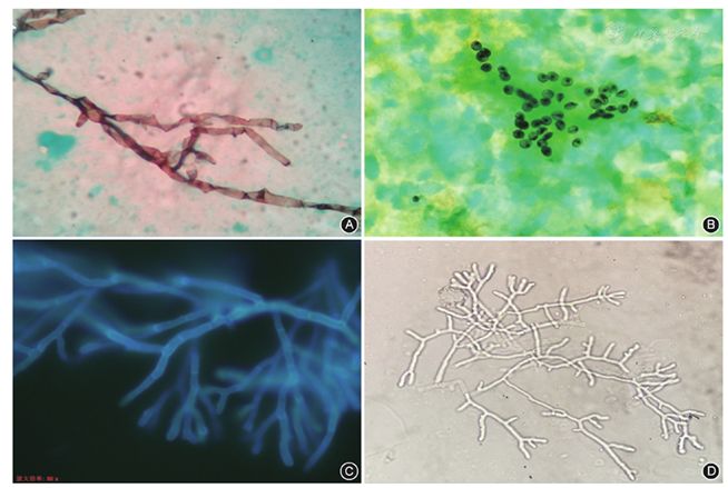 临床微生物实验室真菌检测能力建设基本要求专家共识