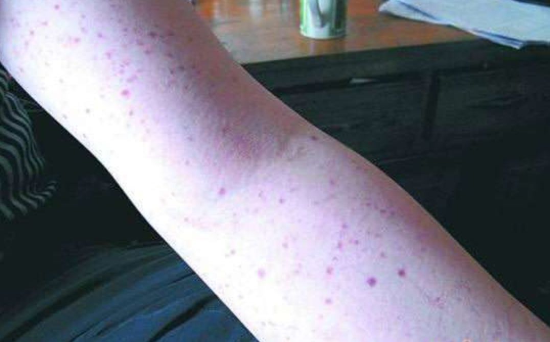 网上吹爆的日本网红产品又翻车了然而你还在用