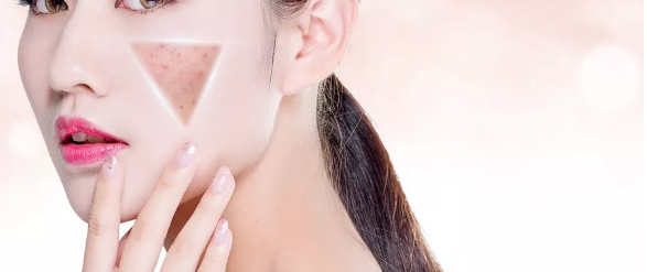 早衰症状让人苦恼,怎么才能身心年轻?_皮肤