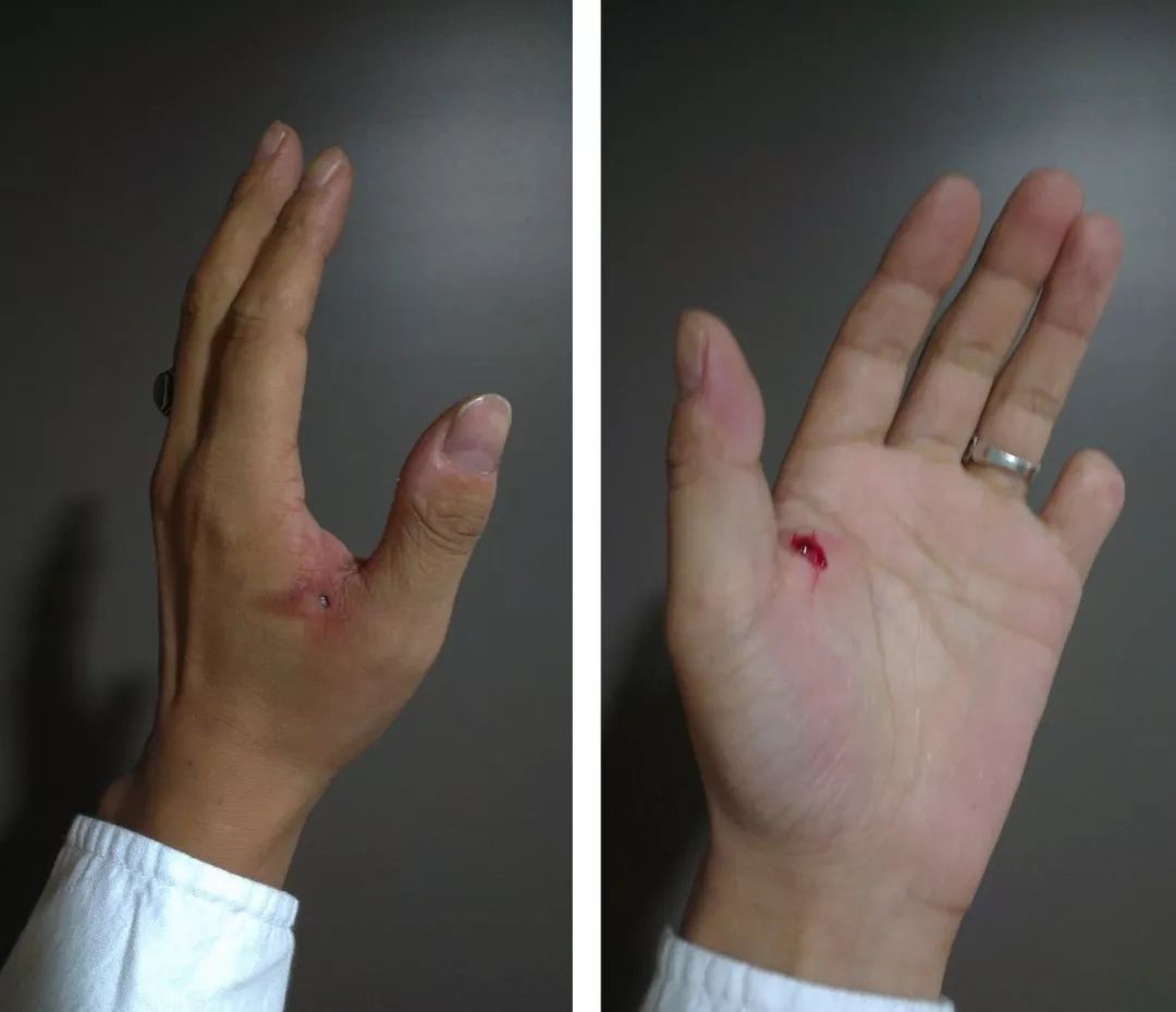 万营人物丨刘成瑞