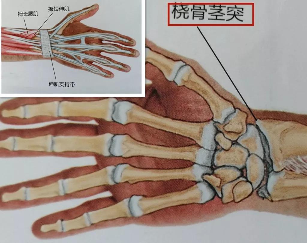 右手弯外衅骨的位置图图片