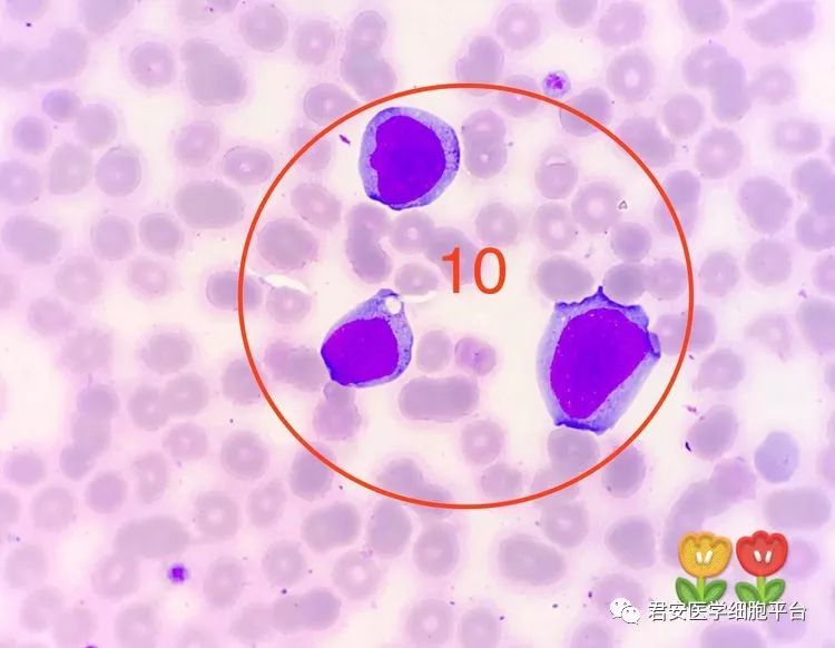 ▼「原,幼单核细胞」形态特征:胞体圆形,类圆形或不规则形;胞浆较多