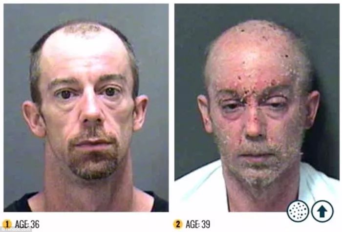 这是一组由美国一反毒机构收集的吸毒者吸毒前后面容变化照片可见毒品