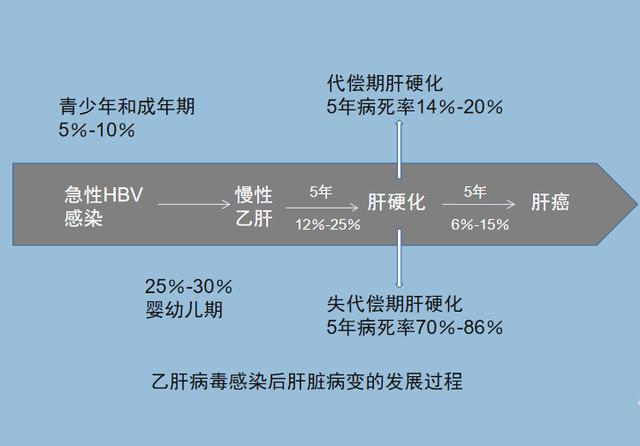 肝硬化作为一种临床上常见的慢性进行性肝病,传统医学一般认为是不可