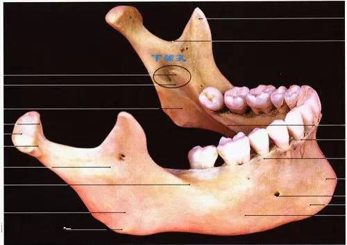 下颌隆突一针三麻图片