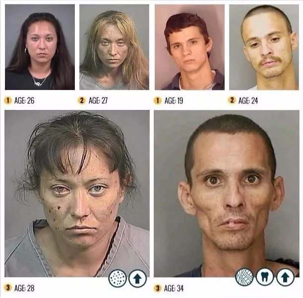 这是一组由美国一反毒机构收集的吸毒者吸毒前后面容变化照片可见毒品