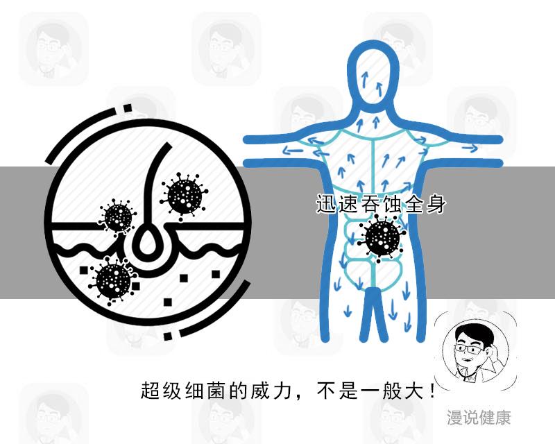 这种吃人的病菌,谁都没想到_细菌