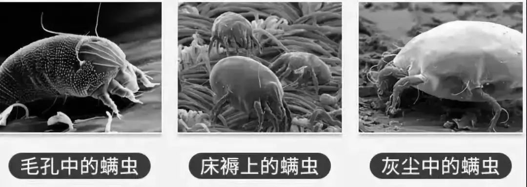 脸油发痒?这样洗脸,5秒搓走螨虫,一块还能洗全身,多年痘痘都没了!