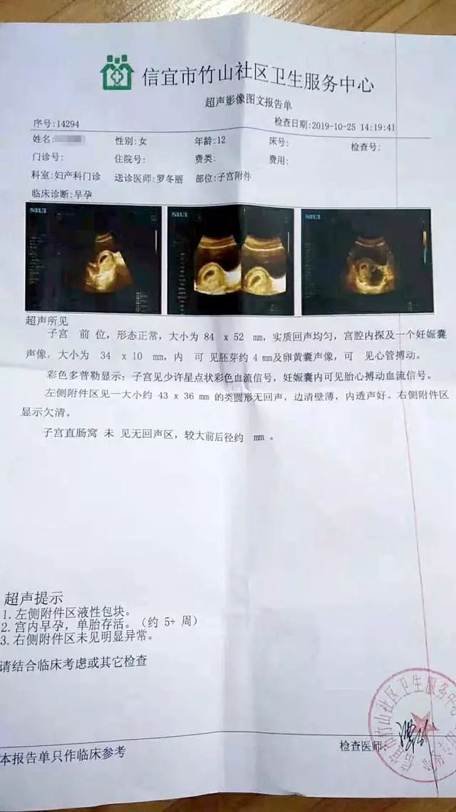 >>>第一次怀孕手术终止妊娠取胚胎警方比对