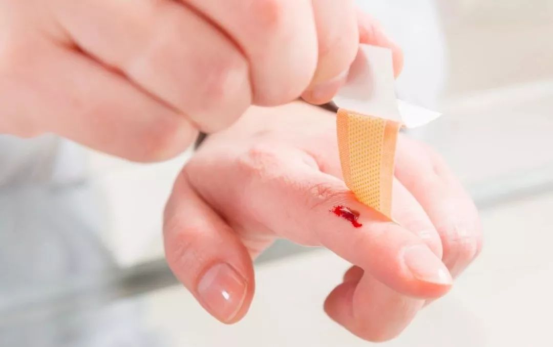 小小创口贴,竟有这么多使用误区!_伤口