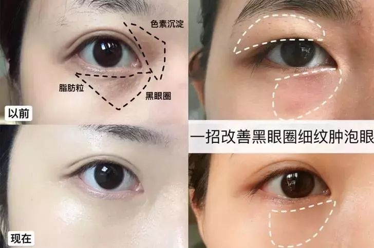 做了430年眼药,一夜成护肤界黑马,淡化黑眼圈太简单了