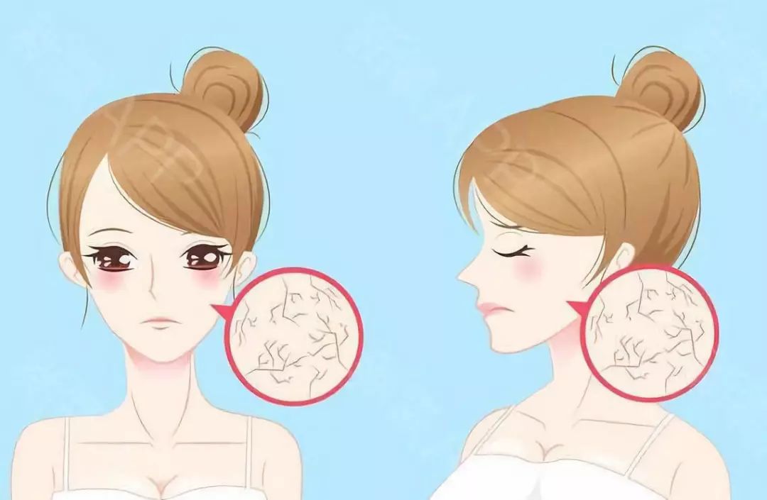 冬季皮肤干燥,起皮怎么办?点这里有答案