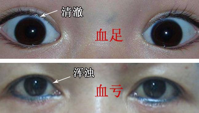 女人老的快,往往这里有问题