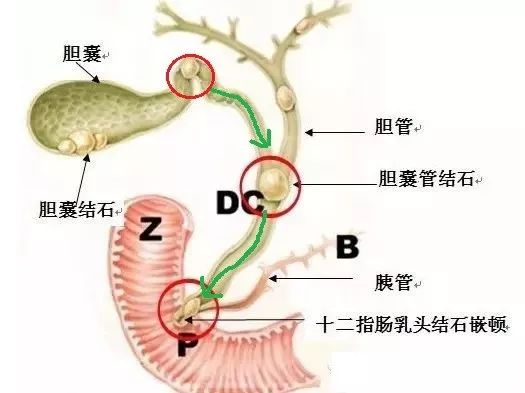 人体胆管