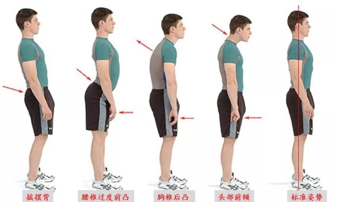 颈椎生理曲度异常那些事