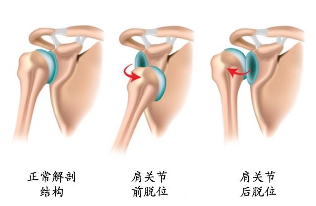 肩右前位示意图图片