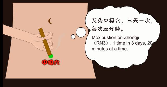 还可以观看《人生必知100穴—尿频》视频,找到中极穴:在下腹部,当脐