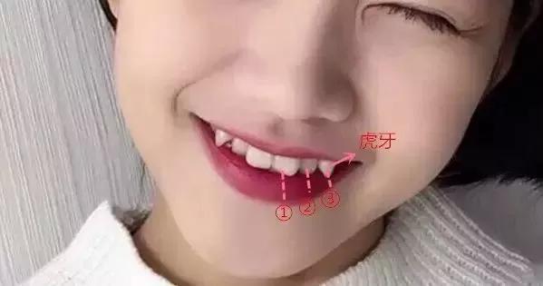 虎牙也叫犬齿(捂脸),从门牙数起的第三颗牙齿(3号牙),又被称为尖牙或