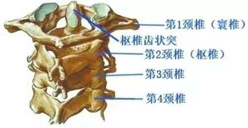 孩子突然歪脖別硬掰可能是寰樞椎半脫位