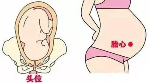 孕30周胎心位置图图片