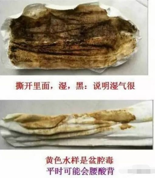 身体有什么问题,雪莲贴就会排出什么毒素,不会看贴的家人赶快了自我