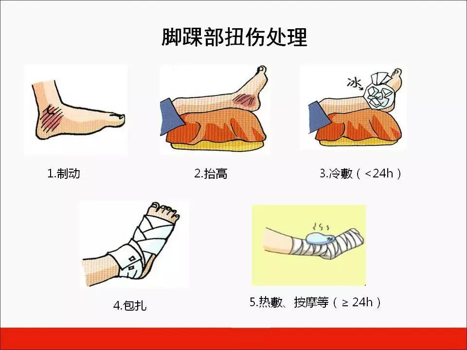 运动损伤急救你学会了吗