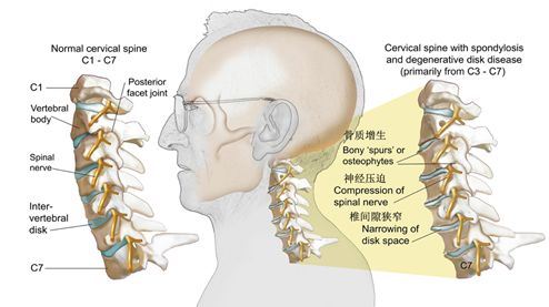 你该好好了解了解它了_颈椎