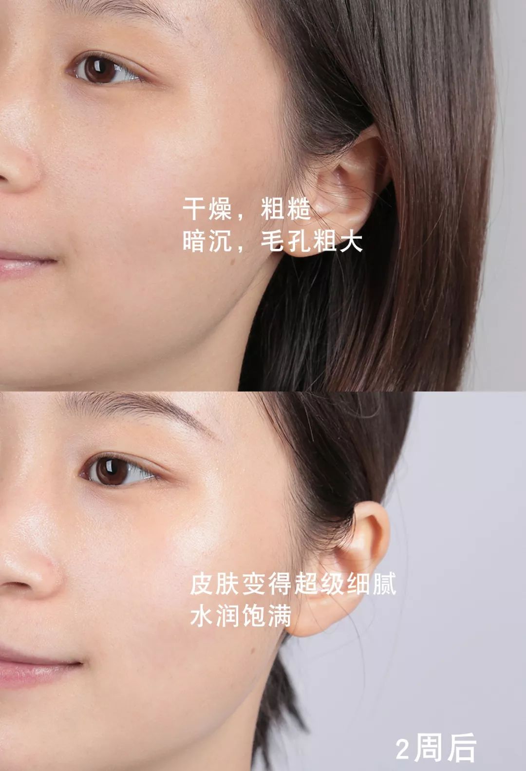 ahc新品g6超越保湿水乳不止补水还能生水