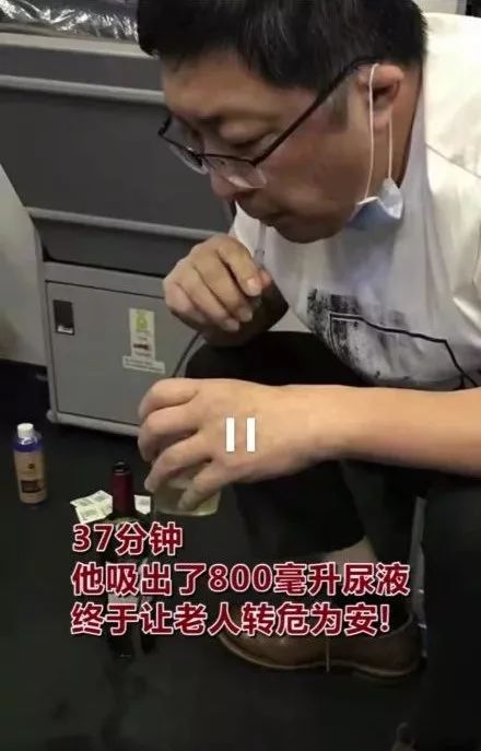 血管外科医生肖占祥赶来,诊断后认为: 老人膀胱大致存有1000毫升尿液