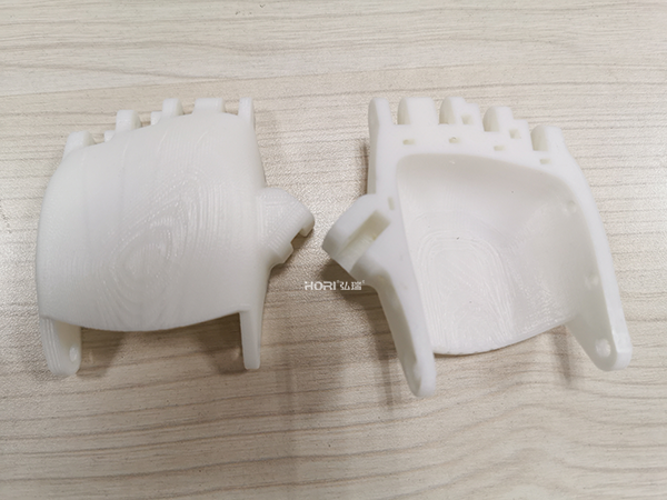 患者|3D打印如何帮助关节炎患者摆脱病痛