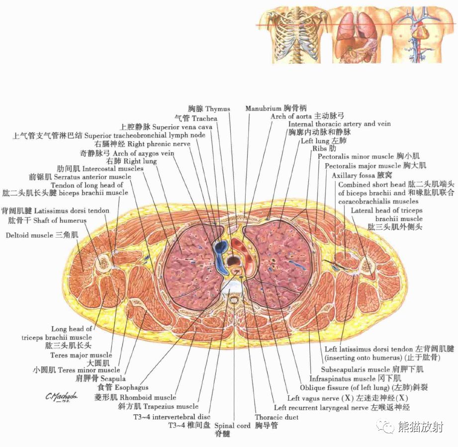 解剖丨縱隔食管胸部斷面