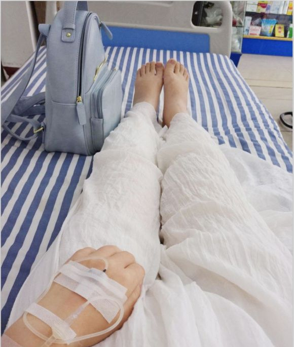 膝盖和脚踝依然还是有些肿,不过我知道才吸脂完得有一个星期的消肿