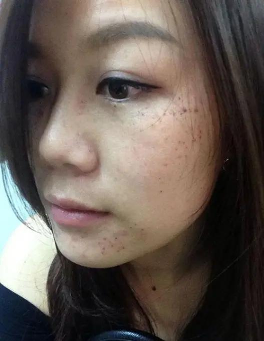 长斑 来自搜狐网