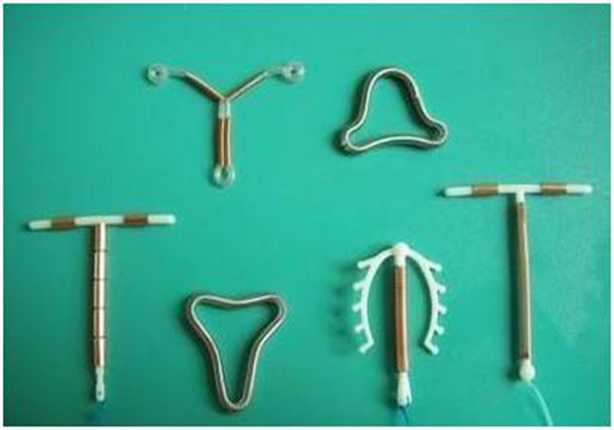 原创避孕上环十年未取节育环超期服役的危害医生都忍不住心疼