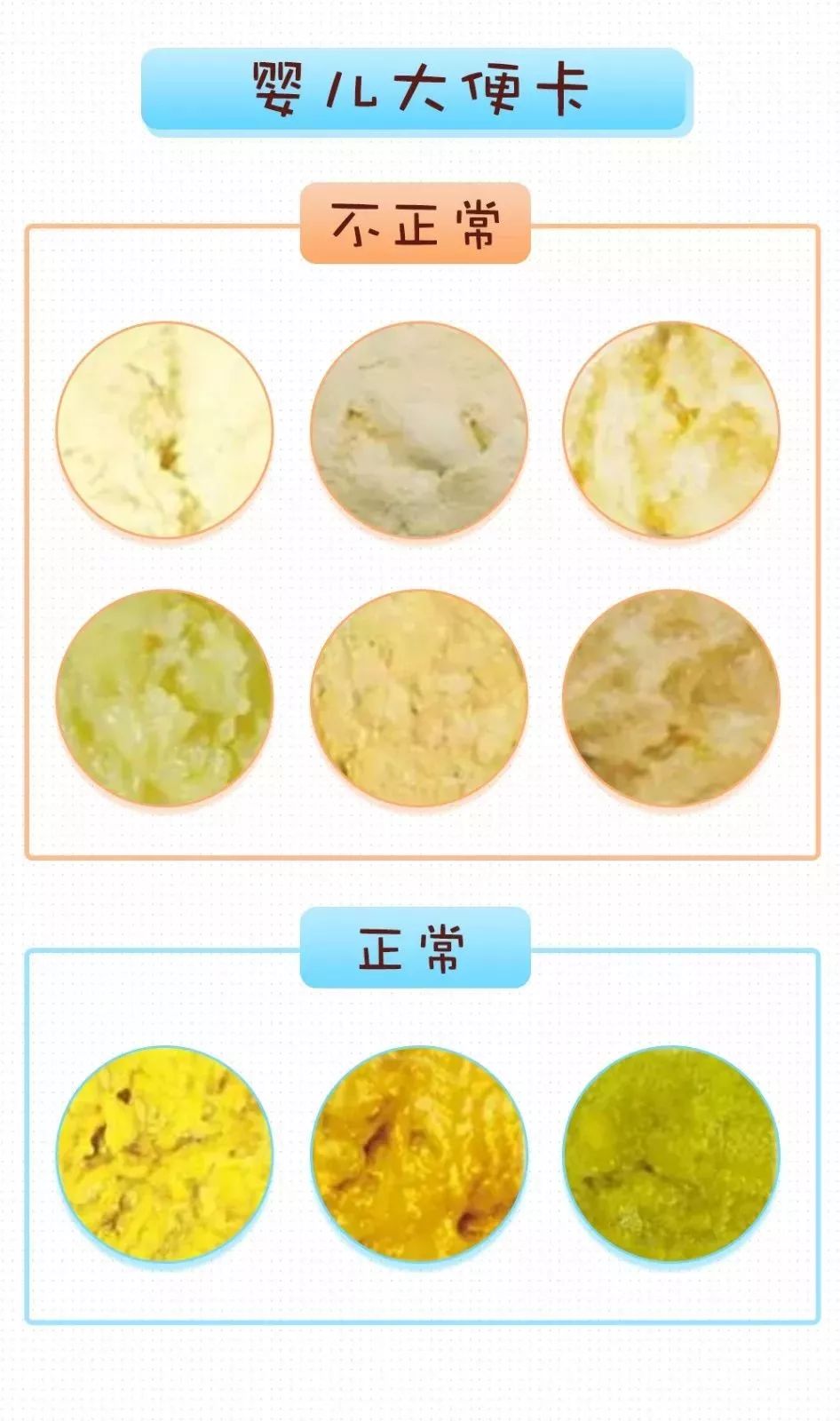 奶瓣绿便腹泻便秘可能是最全的便便文章等于请了一个家庭医生