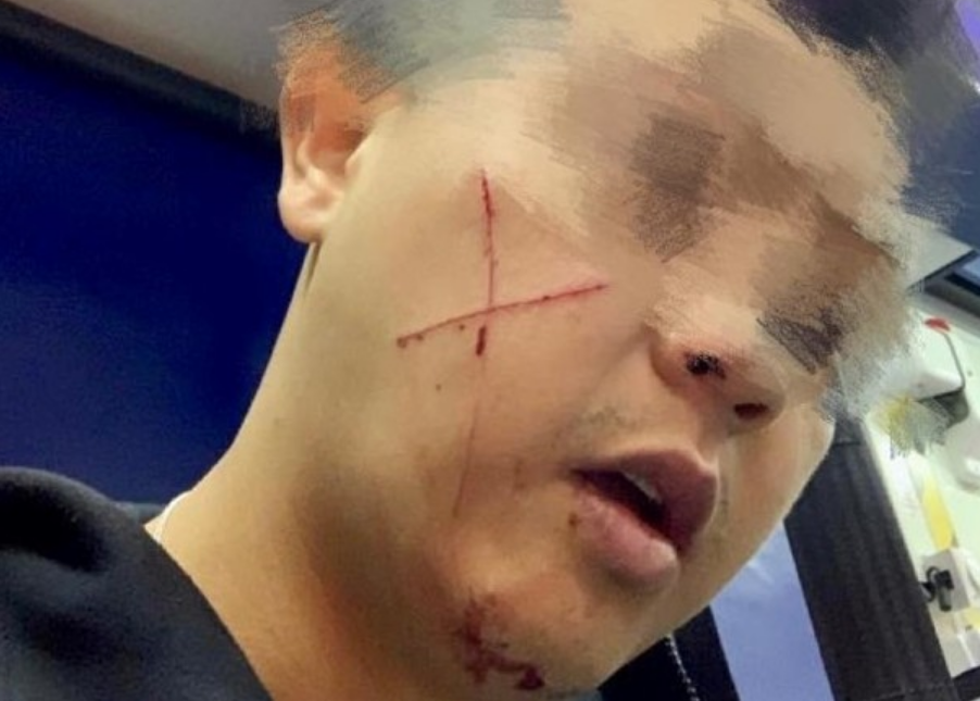 又有港警遭袭!一男子被捕