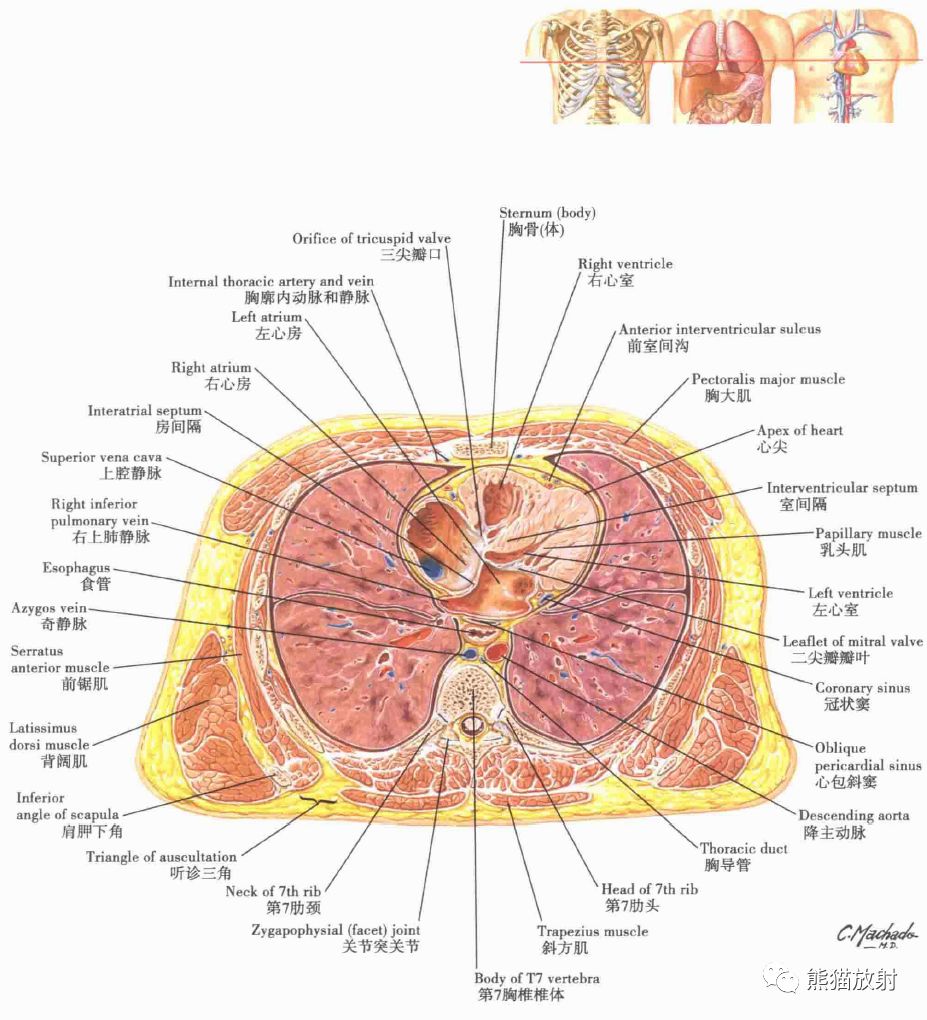 气管食管断面解剖图图片