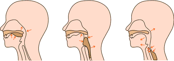 原创吞咽与吞咽障碍