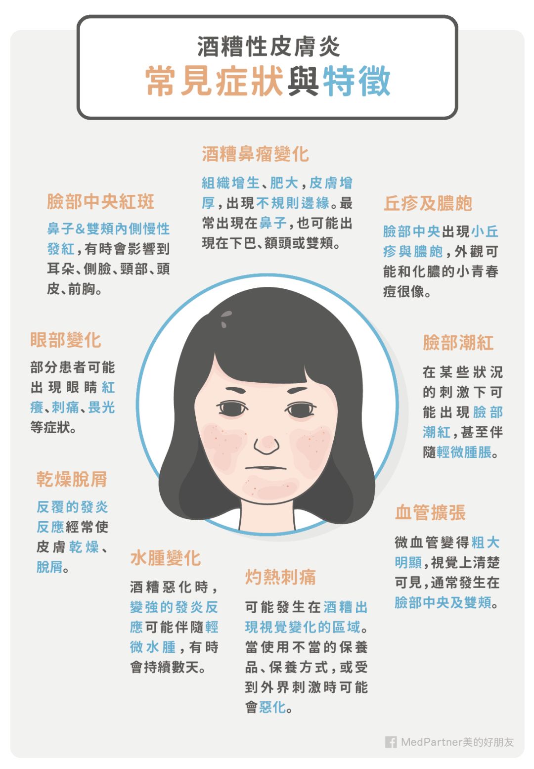 不过脂溢性皮炎有几个特点尤为突出